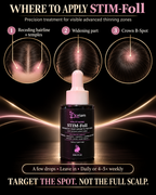 Where to apply ’Koriem STIM-Foll to the hairline, widening part and crown B-spot